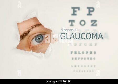 Woman`s eye looking trough teared hole in paper, eye test and word Glaucoma on right. Eye disease concept template. Grey background. Stock Photo